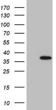 5 Lipoxygenase (ALOX5) antibody