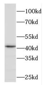 FBXO28 antibody