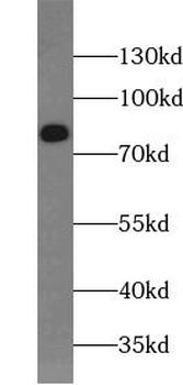 gamma catenin antibody