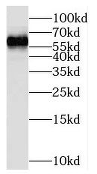 NOP56 antibody