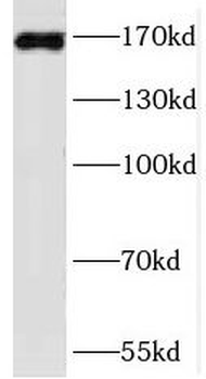 PRDM15 antibody