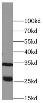 PRSS2 antibody