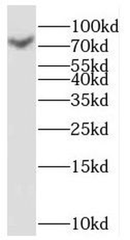 RLIM antibody