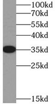 SIX2 antibody