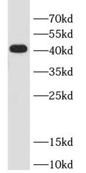 TRBP antibody