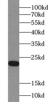 ZNF747 antibody