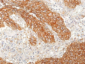 E-Cadherin Antibody