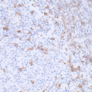 PD-1 Antibody