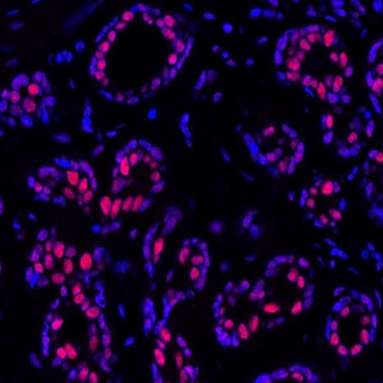 PBRM1 Antibody