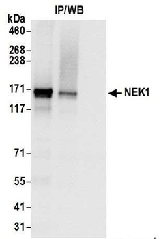 NEK1 Antibody