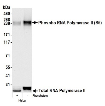 RNA Polymerase II, Phospho (S5) Antibody