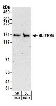 SLITRK5 Antibody