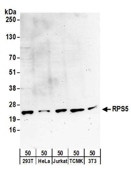 RPS5 Antibody
