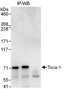 Toca-1 Antibody