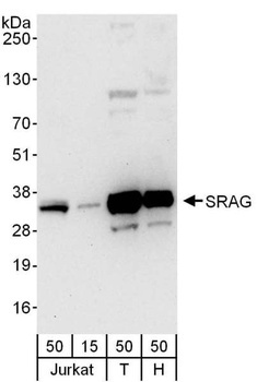 SRAG Antibody