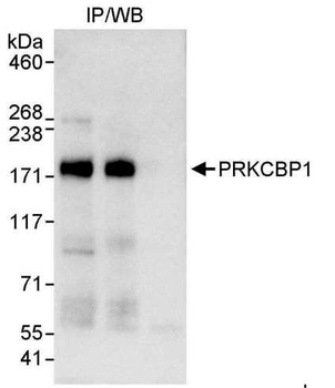 PRKCBP1 Antibody
