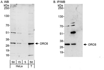 ORC6 Antibody