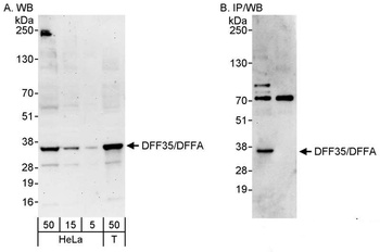 DFF35/DFFA Antibody