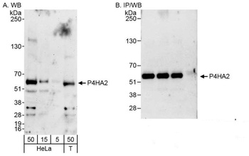 P4HA2 Antibody