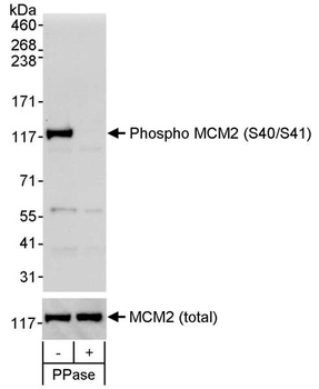 MCM2, Phospho (S40/S41) Antibody