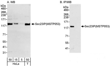 Sec23IP/MSTP053 Antibody