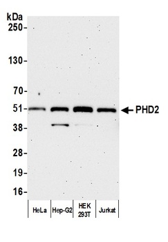 PHD2 Antibody