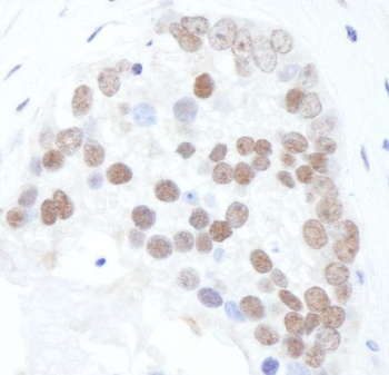 XRCC1, Phospho (S518/T519/T523) Antibody