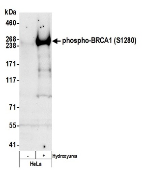 BRCA1, Phospho (S1280) Antibody