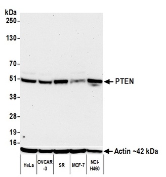 PTEN Antibody