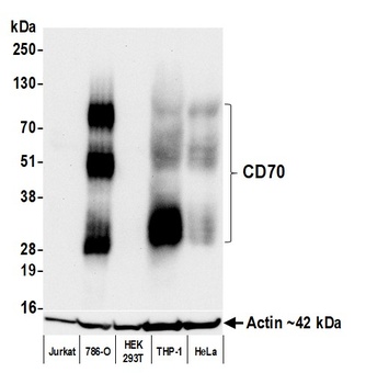CD70 Antibody