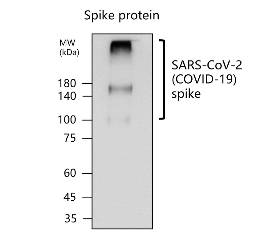 SARS-CoV-2 (COVID-19) Spike protein S2 Antibody