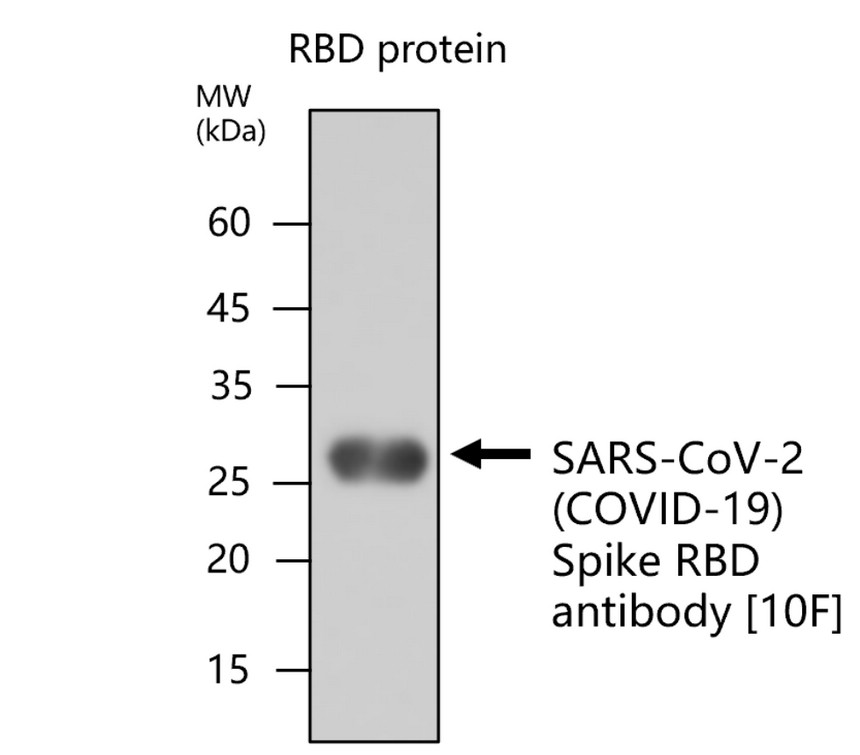 SARS-CoV-2 (COVID-19) Spike RBD antibody [10F]