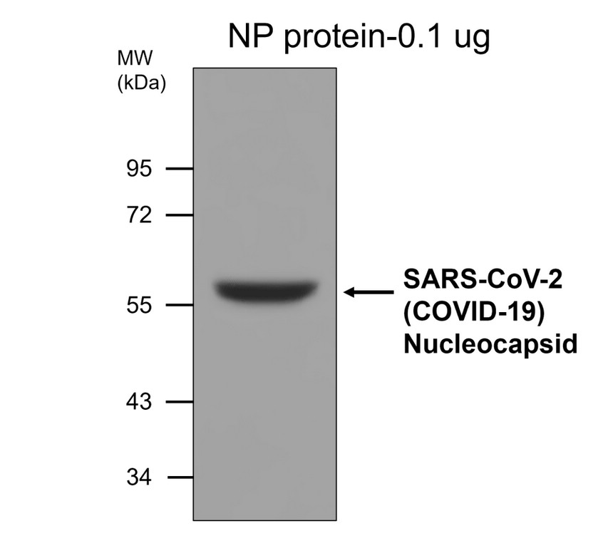 SARS-CoV-2 nucleocapsid protein, monoclonal [6C2D] Antibody