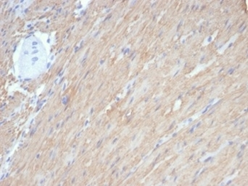 Caldesmon antibody