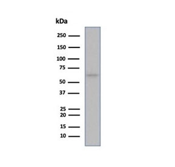 Estrogen Receptor alpha antibody