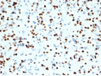 OLIG2 antibody