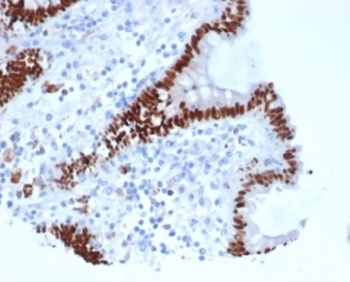 CDX2 antibody