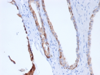 Pan Cytokeratin Cocktail antibody