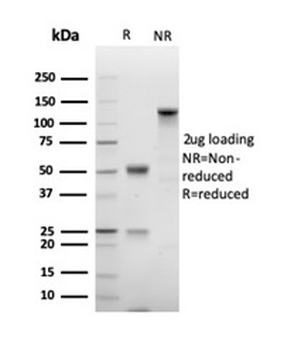 Ki-67 antibody