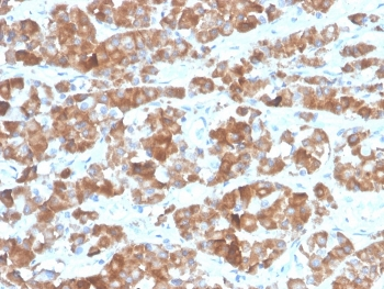 Luteinizing Hormone beta antibody