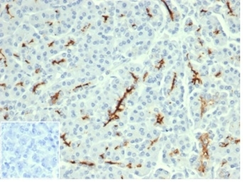 CFTR antibody