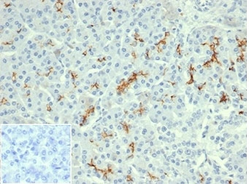 CFTR antibody