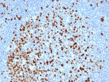 Topoisomerase II alpha antibody
