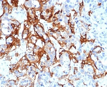 TROP2 antibody