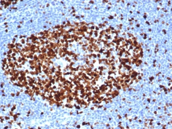 Ki-67 antibody