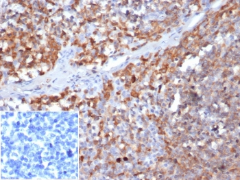 Gamma Parvin antibody