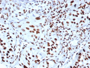 Histone H3 (phospho-S10) antibody