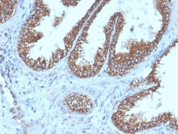 TMEPAI antibody
