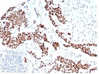 WT1 antibody