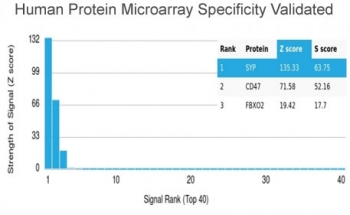 Synaptophysin antibody